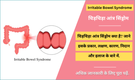 Irritable Bowel Syndrome in Hindi