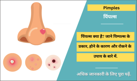 Pimples in Hindi