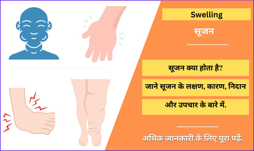  Swelling In Hindi Meaning Symptoms Causes Treatment