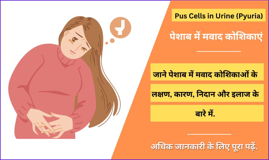 पेशाब में मवाद कोशिकाएं – Pus Cells in Urine (Pyuria) in Hindi