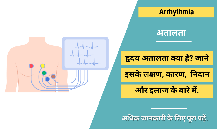 arrhythmia-in-hindi-meaning-symptoms-causes