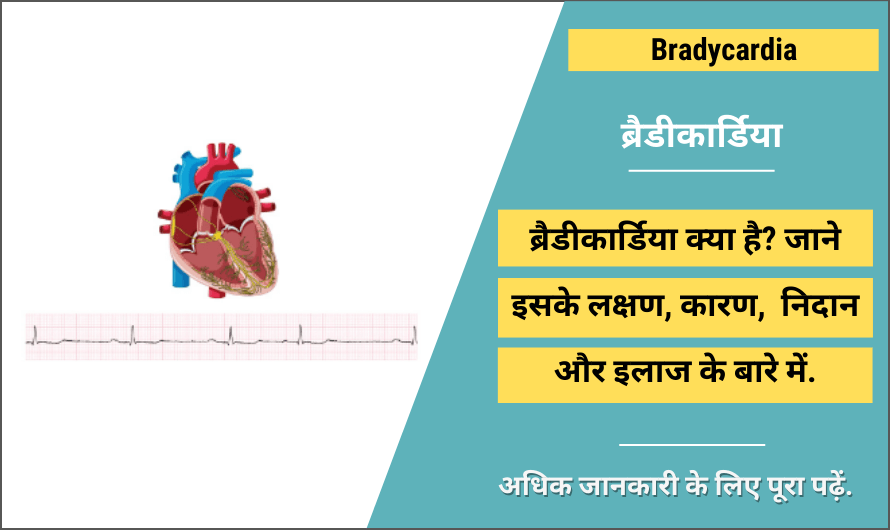 Bradycardia in Hindi