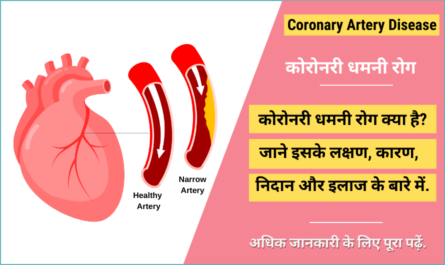 Coronary Artery Disease in Hindi