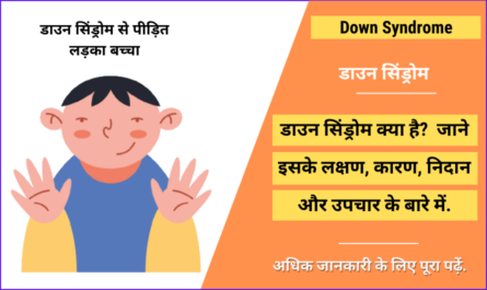 Down Syndrome in Hindi