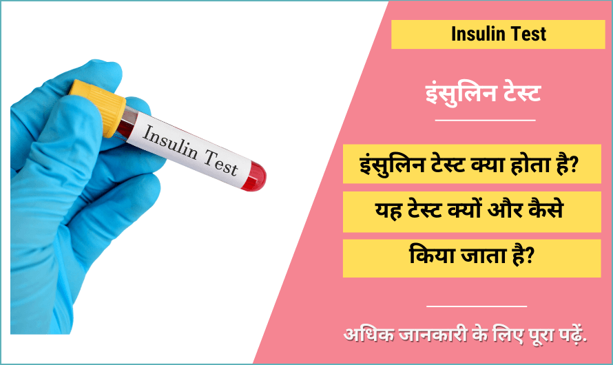 इंसुलिन टेस्ट – Insulin Test in Hindi
