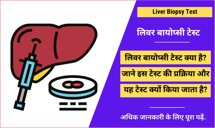 लिवर बायोप्सी टेस्ट – Liver Biopsy Test in Hindi