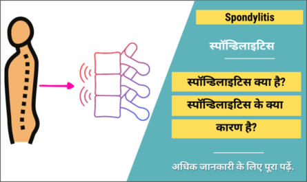 Spondylitis in Hindi