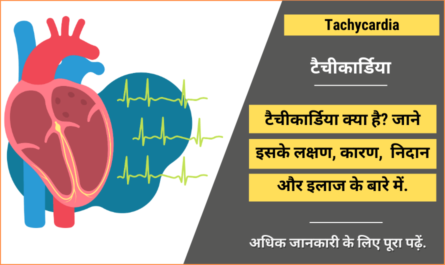Tachycardia in Hindi