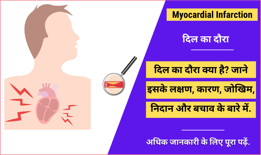 दिल का दौरा - Myocardial Infarction in Hindi