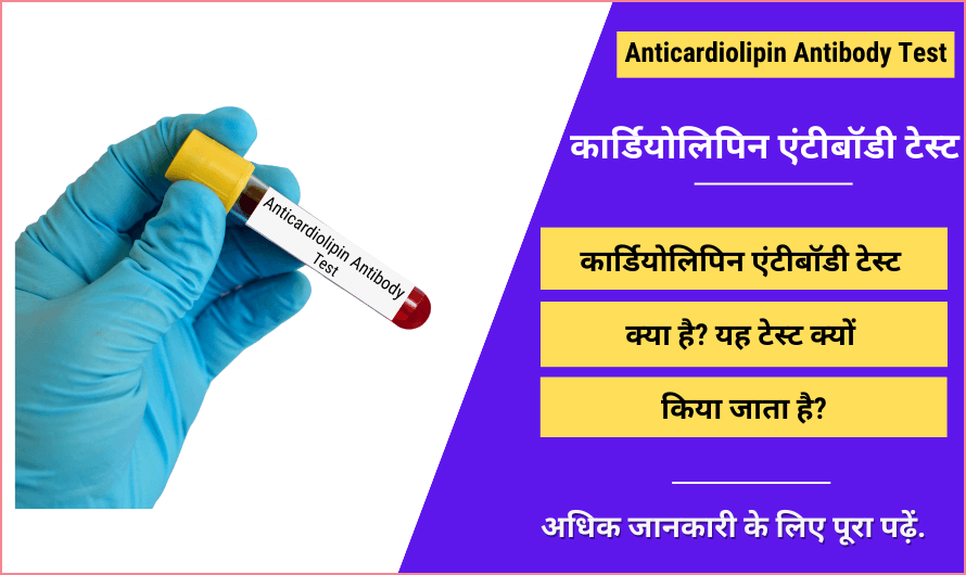 कार्डियोलिपिन एंटीबॉडी टेस्ट – Anticardiolipin Antibody Test in Hindi