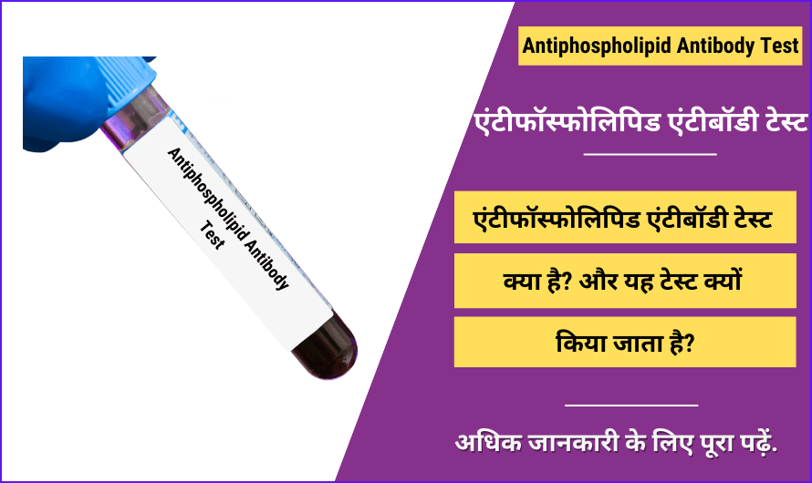 एंटीफॉस्फोलिपिड एंटीबॉडी टेस्ट – Antiphospholipid Antibody Test in Hindi