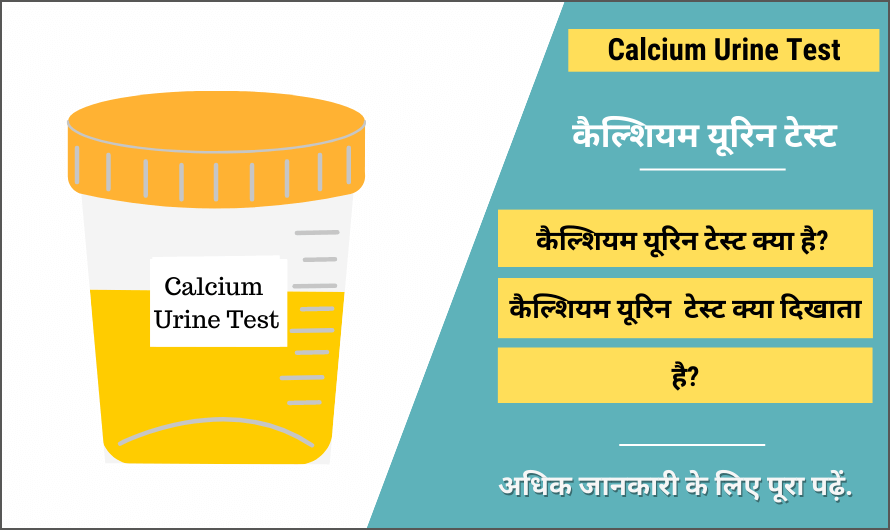 कैल्शियम यूरिन टेस्ट – Calcium Urine Test in Hindi