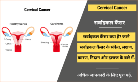Cervical Cancer in Hindi