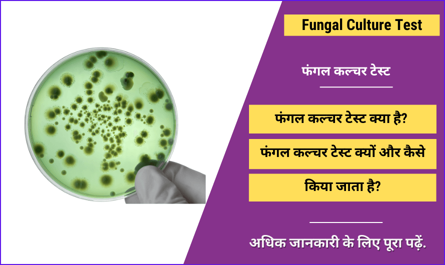 Fungal Culture Test in Hindi