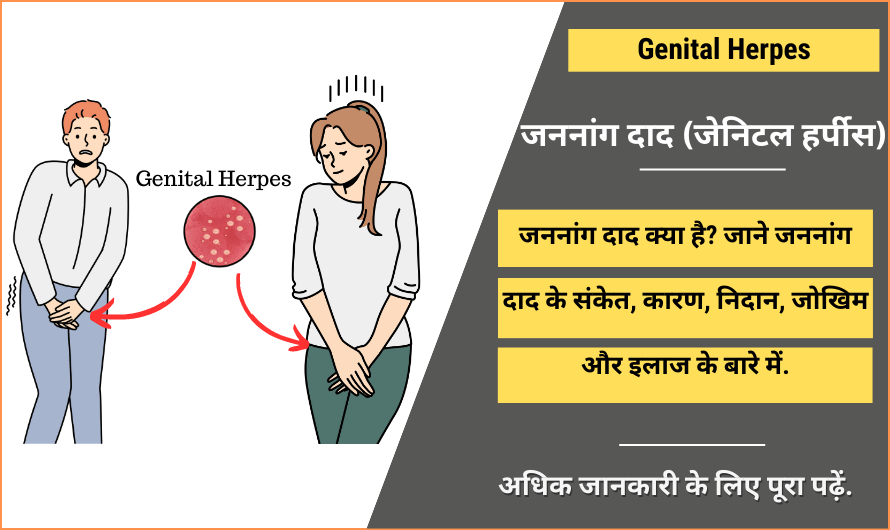Genital Herpes in Hindi