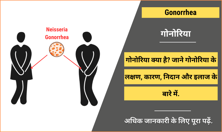 Gonorrhea in Hindi