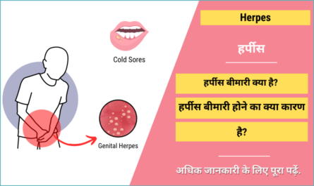 Herpes in Hindi