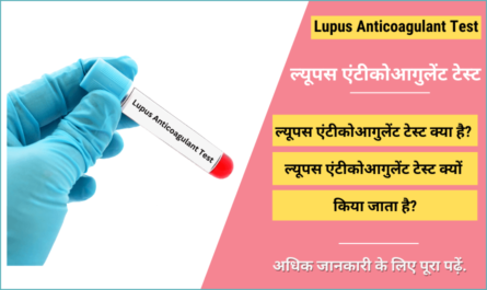 Lupus Anticoagulant Test in Hindi