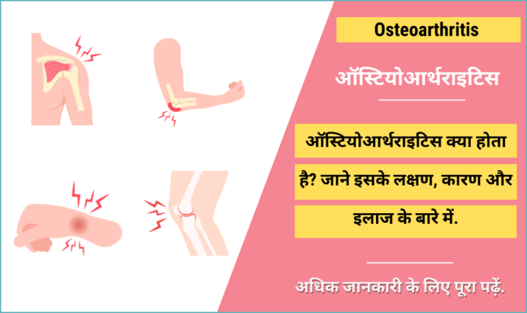 osteoarthritis-in-hindi-meaning-symptoms