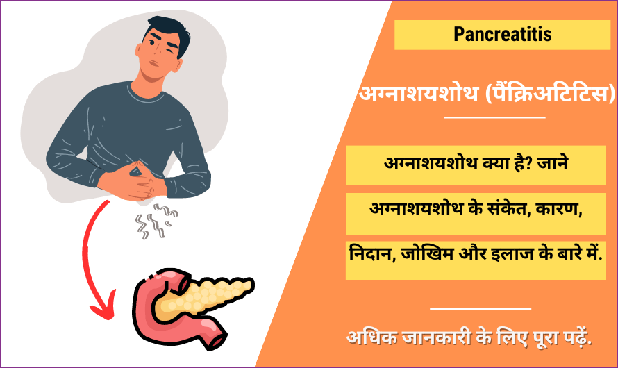 अग्नाशयशोथ (पैंक्रिअटिटिस) – Pancreatitis in Hindi