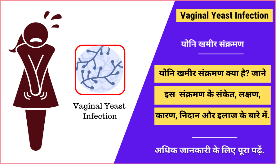 Vaginal Yeast Infection in Hindi