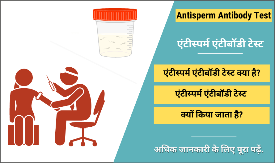 एंटीस्पर्म एंटीबॉडी टेस्ट – Antisperm Antibody Test in Hindi