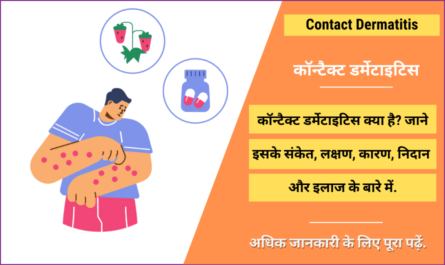 Contact Dermatitis in Hindi
