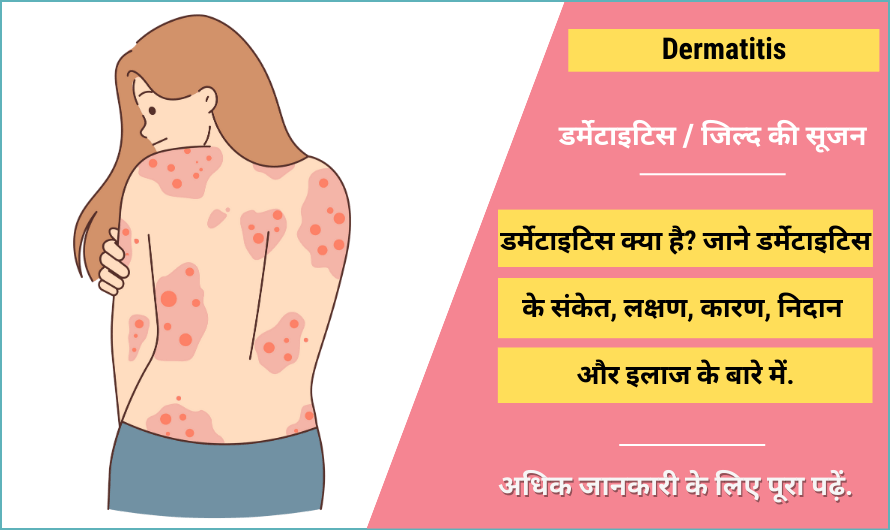 Dermatitis in Hindi