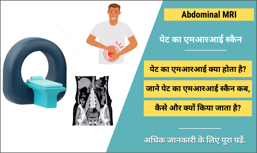 पेट का एमआरआई स्कैन – Abdominal MRI in Hindi