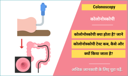 Colonoscopy in Hindi
