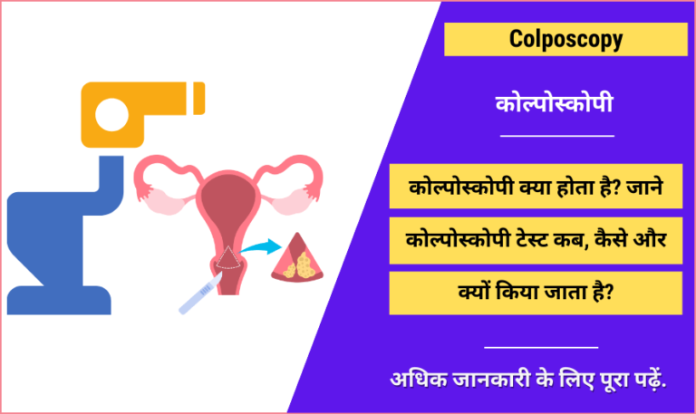 कोल्पोस्कोपी - Colposcopy in Hindi, Reasons, Results, Cost