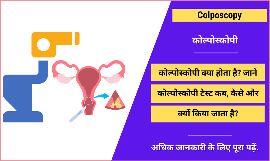 Colposcopy in Hindi