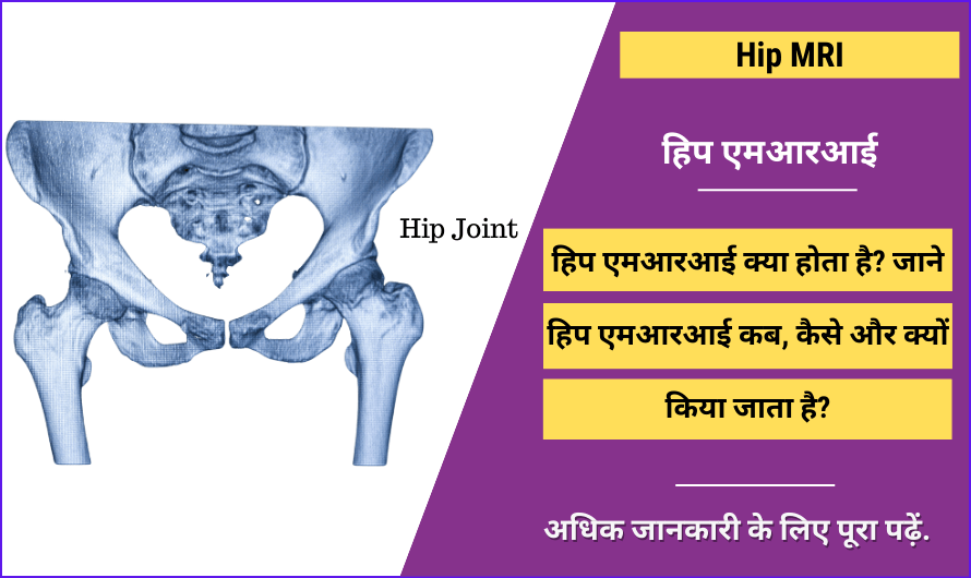 Hip MRI in Hindi