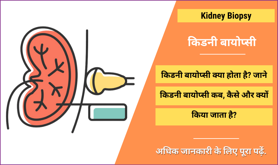 किडनी बायोप्सी – Kidney Biopsy in Hindi