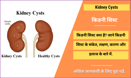Kidney Cysts in Hindi