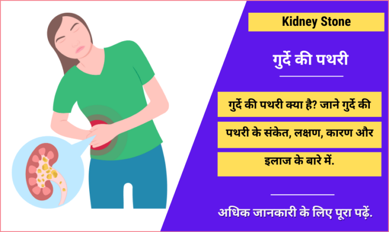 kidney-stone-in-hindi-symptoms-causes-treatment