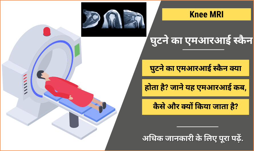 Knee MRI in Hindi