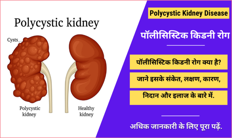 polycystic-kidney-disease-in-hindi-causes