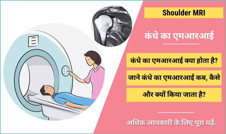 कंधे का एमआरआई – Shoulder MRI in Hindi