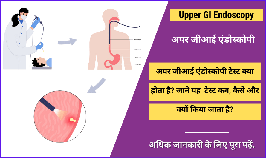 Upper GI Endoscopy in Hindi