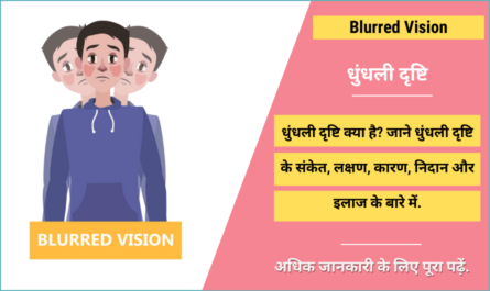 Blurred Vision in Hindi