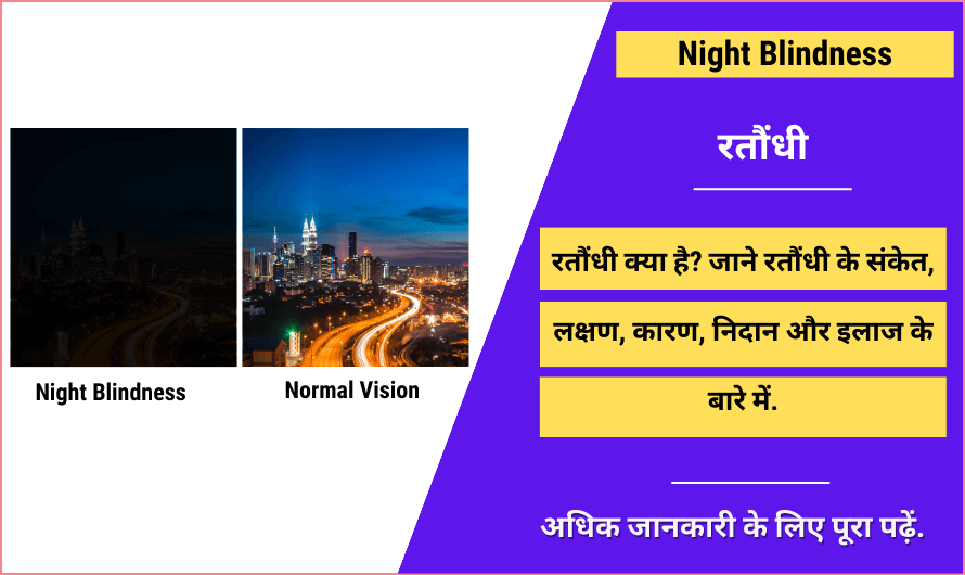 रतौंधी – Night Blindness in Hindi