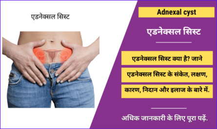 Adnexal cyst in Hindi