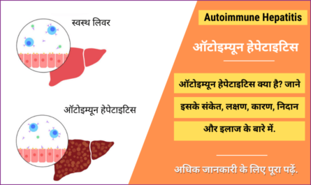 Autoimmune Hepatitis in Hindi