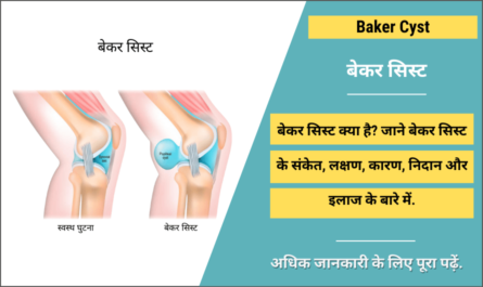 Baker Cyst in Hindi
