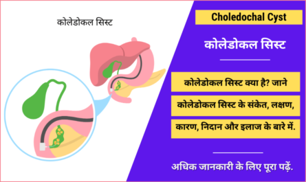 Choledochal Cyst in Hindi