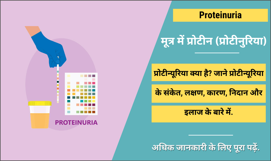 मूत्र में प्रोटीन (प्रोटीन्यूरिया) – Proteinuria in Hindi