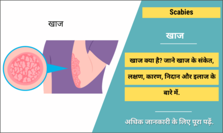 Scabies in Hindi