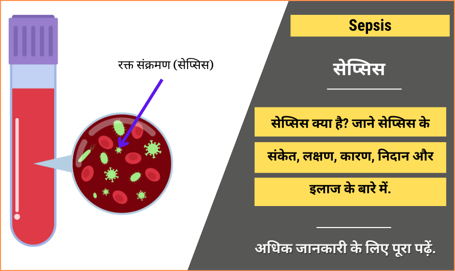 Severe Sepsis Meaning In Hindi At Lloyd Mckeever Blog Severe Sepsis Meaning In Hindi At Lloyd Mckeever Blog