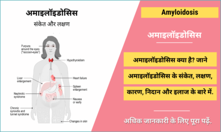 Amyloidosis in Hindi